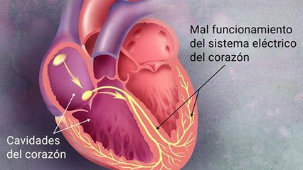 Trastornos del ritmo cardíaco
