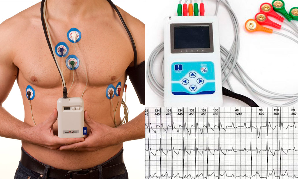 HOLTER CARDIOLÓGICO HOLTER CARDIOLÓGICO