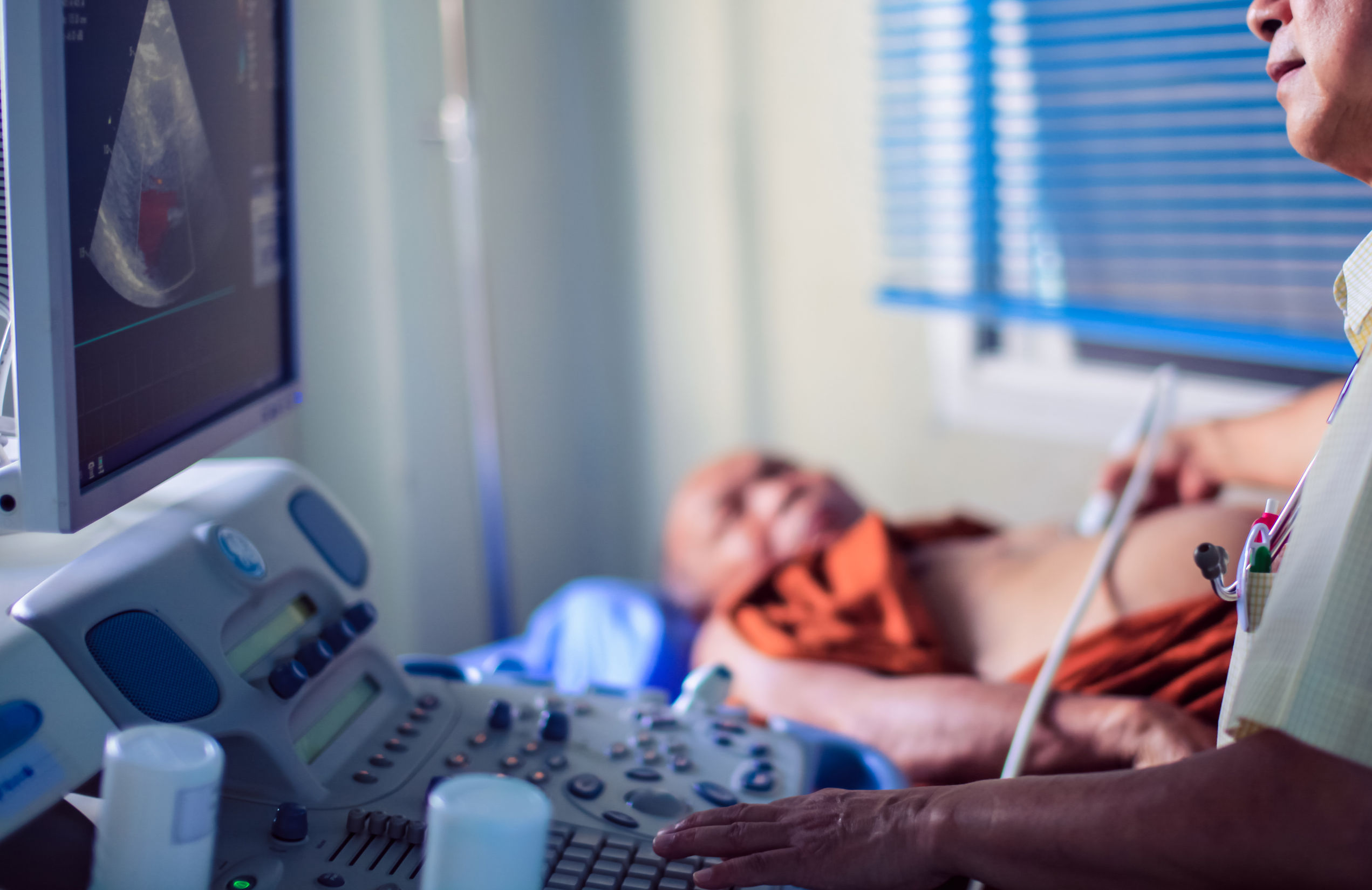 Ecocardiograma Transtoracico Ecocardiograma Transtoracico